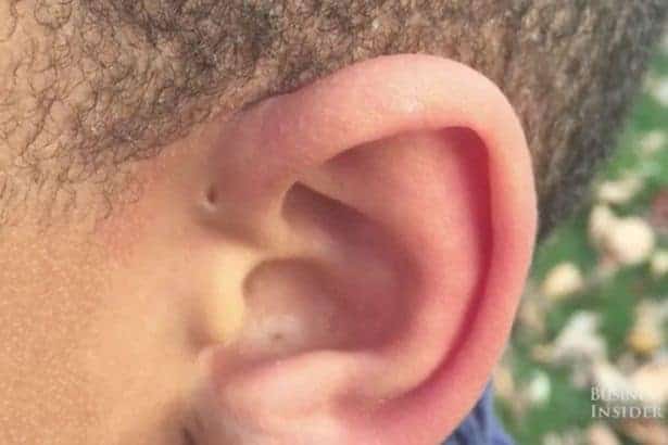 ear holes 