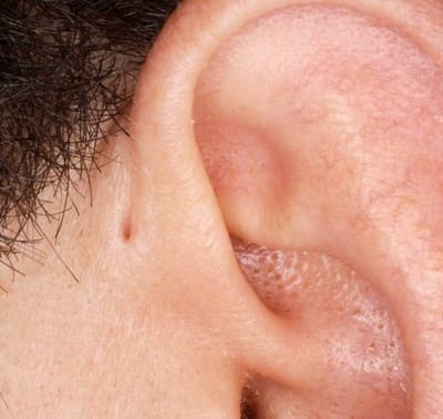 ear holes 
