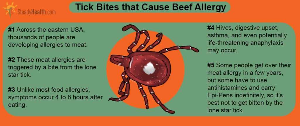 Ticks That Can Make You Allergic To Red Meat Are Spreading Fast