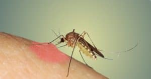 get rid of mosquito bites