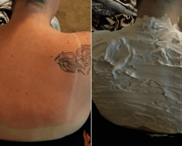 shaving cream sunburn hack